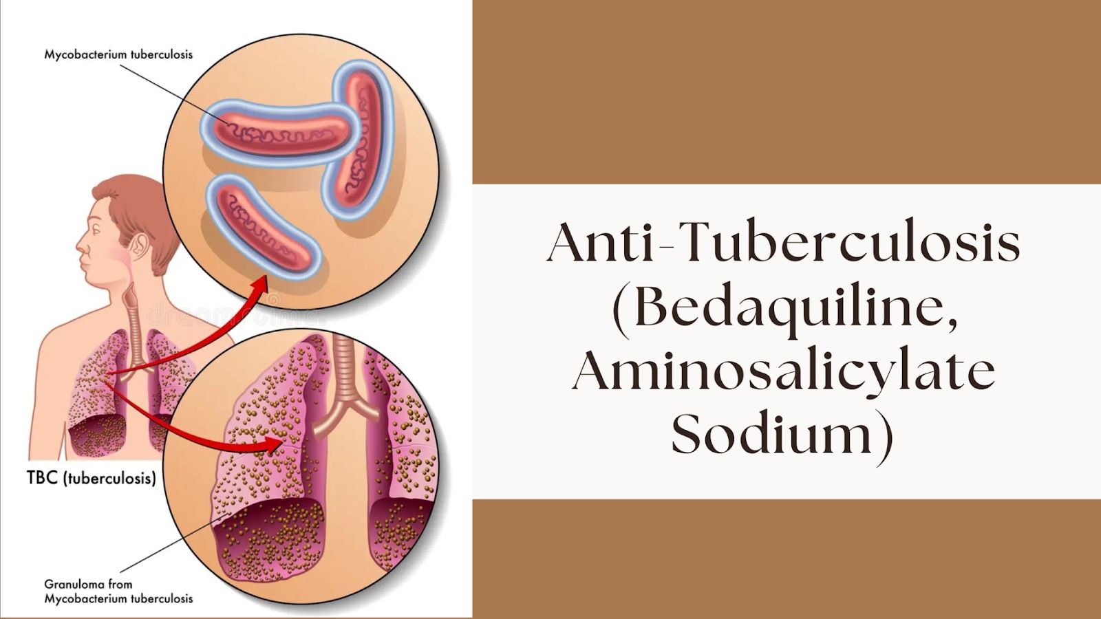 Anti-Tuberculosis (Bedaquiline, Aminosalicylate Sodium)​